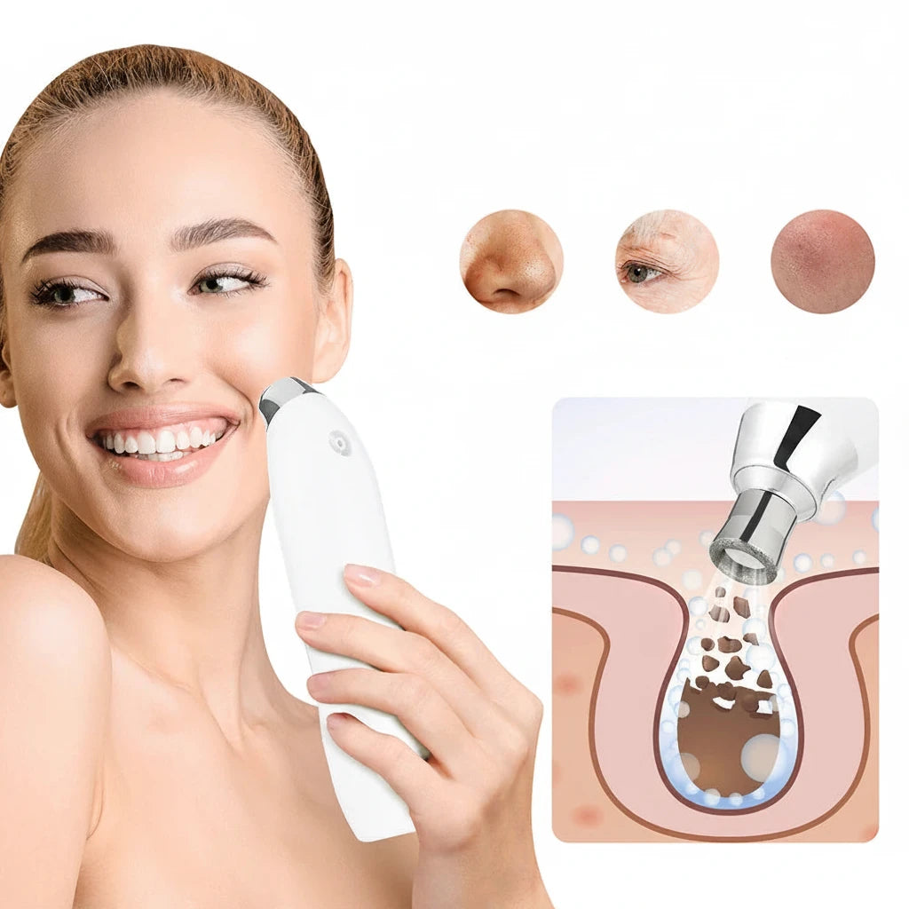 DermaGlow Diamond Microdermabrasion System