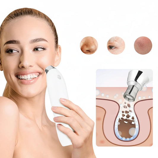 DermaGlow Diamond Microdermabrasion System